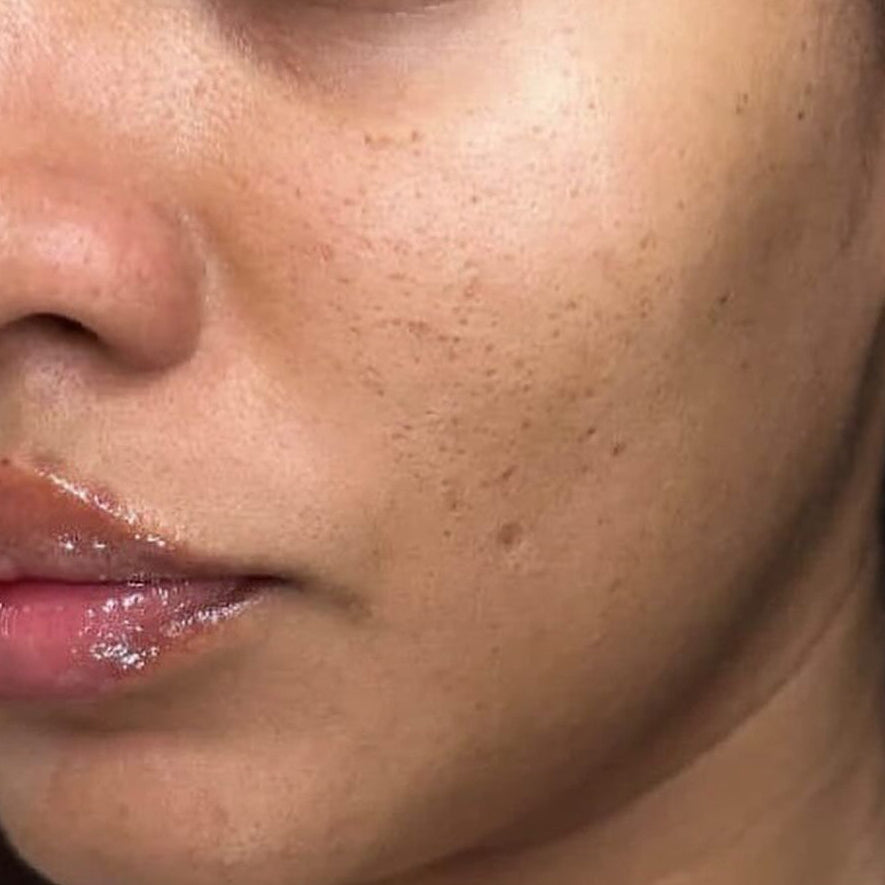 Close-up of a person's face with a neutral expression